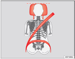 Abb. 87 Von vorne betrachtet: richtig eingestellte Kopfstütze und korrekter Gurtbandverlauf
